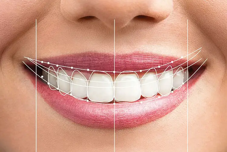 Full Mouth Rehabilitation treatment at Dr. Varshney's Dental Aesthetics in Nani Daman